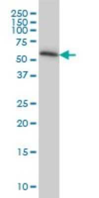 Western Blot: TROVE2 Antibody (1F2) [H00006738-M03]