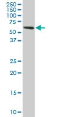 Western Blot: TROVE2 Antibody (2B4) [H00006738-M01]