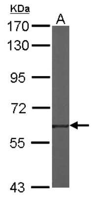 Western Blot: TROVE2 Antibody [NBP1-32125]