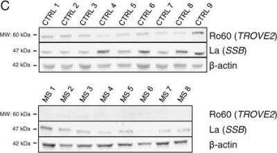 Western Blot: TROVE2 Antibody [NBP1-86998]