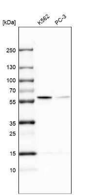 Western Blot: TROVE2 Antibody [NBP2-55127]