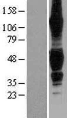 Western Blot: TROY/TNFRSF19 Overexpression Lysate [NBL1-17153]