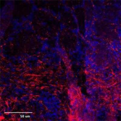 Immunocytochemistry/ Immunofluorescence: TRPC1 Antibody [NB100-98844]