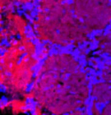Immunocytochemistry/ Immunofluorescence: TRPC1 Antibody [NB100-98844]