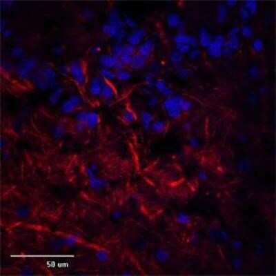 Immunocytochemistry/ Immunofluorescence: TRPC1 Antibody [NB100-98844]