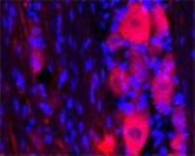 Immunocytochemistry/ Immunofluorescence: TRPC1 Antibody [NB100-98844]