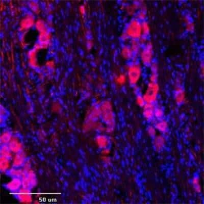 Immunocytochemistry/ Immunofluorescence: TRPC1 Antibody [NB100-98844]