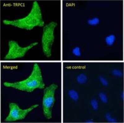 Immunocytochemistry/ Immunofluorescence: TRPC1 Antibody [NBP2-62000]