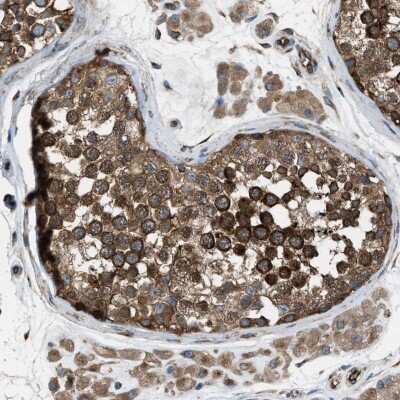 Immunohistochemistry-Paraffin: TRPC1 Antibody [NBP1-89648]