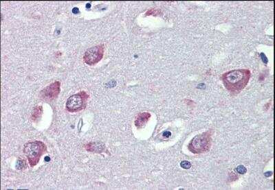 Immunohistochemistry-Paraffin: TRPC1 Antibody [NBP2-62000]