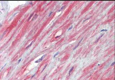 Immunohistochemistry-Paraffin: TRPC1 Antibody [NBP2-62000]