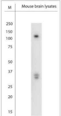 Western Blot: TRPC1 Antibody [NBP2-50090]