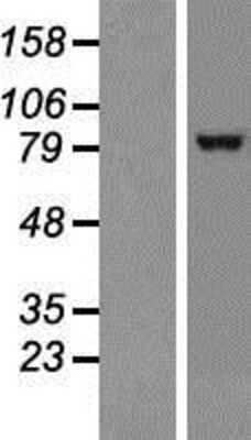 Western Blot: TRPC1 Overexpression Lysate [NBP2-10883]