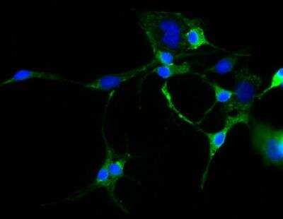 Immunocytochemistry/ Immunofluorescence: TRP2 Antibody [NBP1-86893]