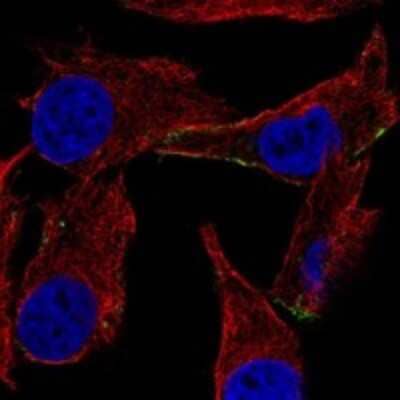 Immunocytochemistry/ Immunofluorescence: TRP2 Antibody [NBP3-17952]