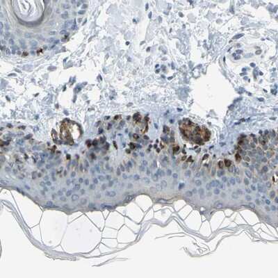 Immunohistochemistry-Paraffin: TRP2 Antibody [NBP1-86892]