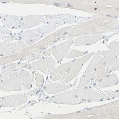 Immunohistochemistry-Paraffin: TRP2 Antibody [NBP1-86892]