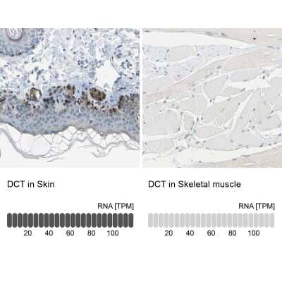 Immunohistochemistry-Paraffin: TRP2 Antibody [NBP1-86892]