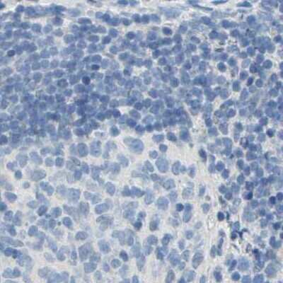 Immunohistochemistry-Paraffin: TRP2 Antibody [NBP1-86892]