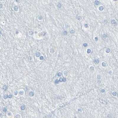 Immunohistochemistry-Paraffin: TRP2 Antibody [NBP1-86892]