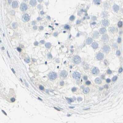Immunohistochemistry-Paraffin: TRP2 Antibody [NBP1-86892]