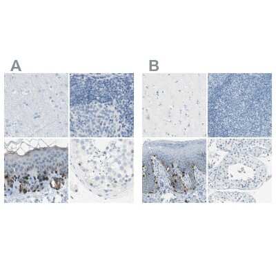 Immunohistochemistry-Paraffin: TRP2 Antibody [NBP1-86892]