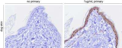 Immunohistochemistry-Paraffin: TRP2 Antibody [NBP1-86892]