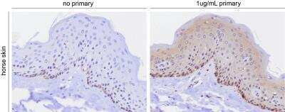 Immunohistochemistry-Paraffin: TRP2 Antibody [NBP1-86892]