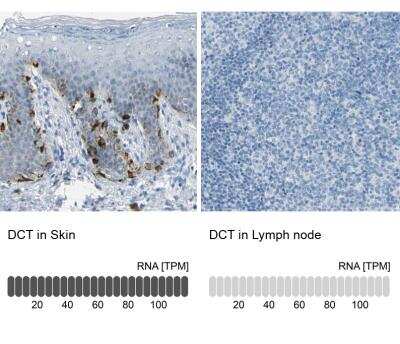 Immunohistochemistry-Paraffin: TRP2 Antibody [NBP1-86893]