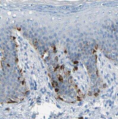 Immunohistochemistry-Paraffin: TRP2 Antibody [NBP1-86893]