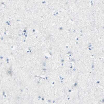 Immunohistochemistry-Paraffin: TRP2 Antibody [NBP1-86893]