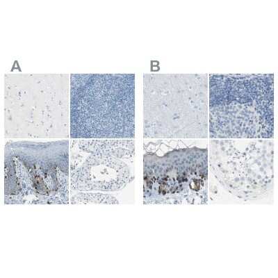 Immunohistochemistry-Paraffin: TRP2 Antibody [NBP1-86893]