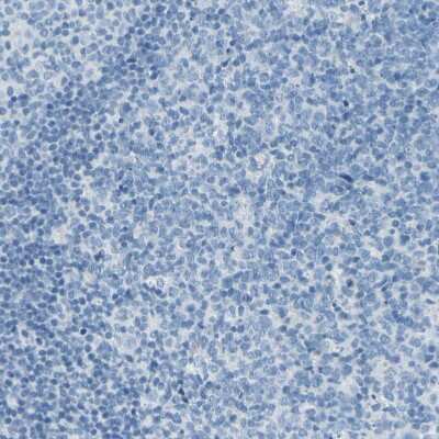 Immunohistochemistry-Paraffin: TRP2 Antibody [NBP1-86893]