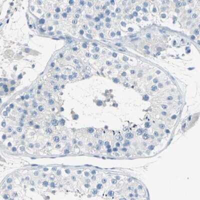 Immunohistochemistry-Paraffin: TRP2 Antibody [NBP1-86893]