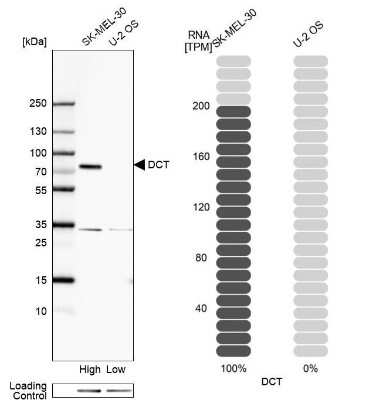 Western Blot: TRP2 Antibody [NBP1-86893]