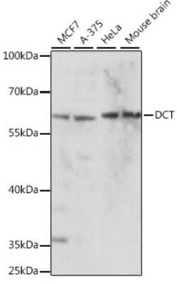 Western Blot: TRP2 AntibodyAzide and BSA Free [NBP2-93634]