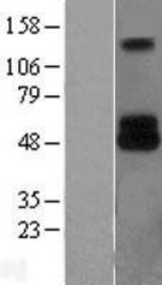 Western Blot: TRP2 Overexpression Lysate [NBL1-09748]