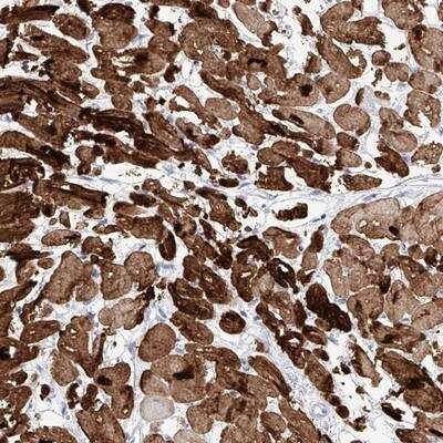 Immunohistochemistry-Paraffin: TRP7 Antibody [NBP1-87523]