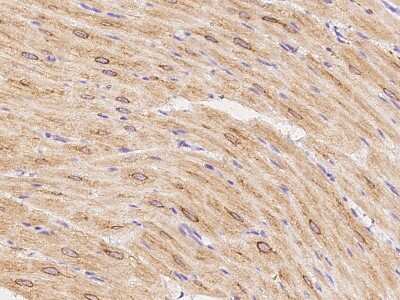 Immunohistochemistry-Paraffin: TRP7 Antibody [NBP2-99522]