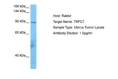 Western Blot: TRP7 Antibody [NBP2-88489]