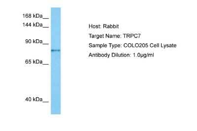 Western Blot: TRP7 Antibody [NBP2-88490]