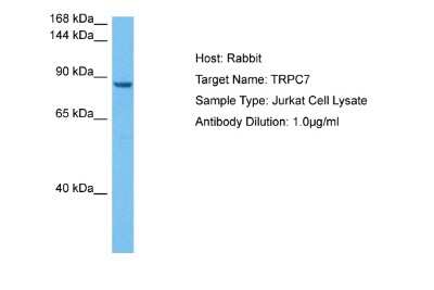 Western Blot: TRP7 Antibody [NBP2-88491]