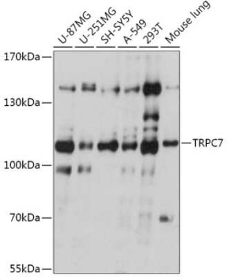 Western Blot: TRP7 AntibodyAzide and BSA Free [NBP2-94388]