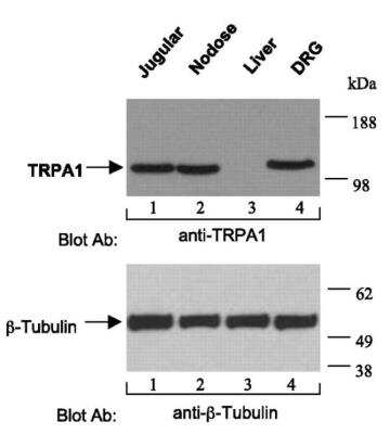 Western Blot: TRPA1 Antibody (6G8) [H00008989-M03]