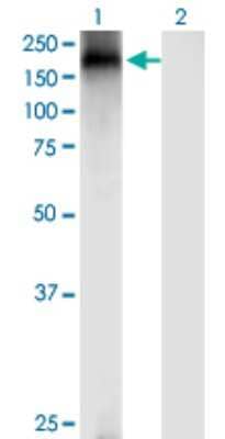 Western Blot: TRPA1 Antibody (6G8) [H00008989-M03]