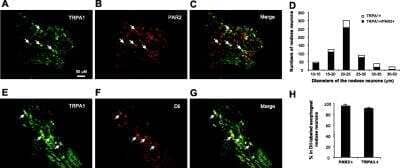 Immunocytochemistry/ Immunofluorescence: TRPA1 Antibody [NB100-98841]