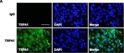 Immunocytochemistry/ Immunofluorescence: TRPA1 Antibody - BSA Free [NB110-40763]