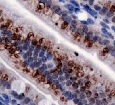 Immunohistochemistry: TRPA1 Antibody - BSA Free [NB110-40763]