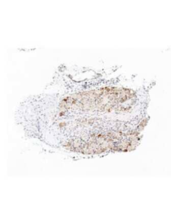 Immunohistochemistry: TRPA1 Antibody [NBP3-10359]