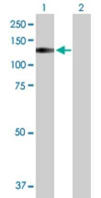 Western Blot: TRPA1 Antibody [H00008989-D01P]